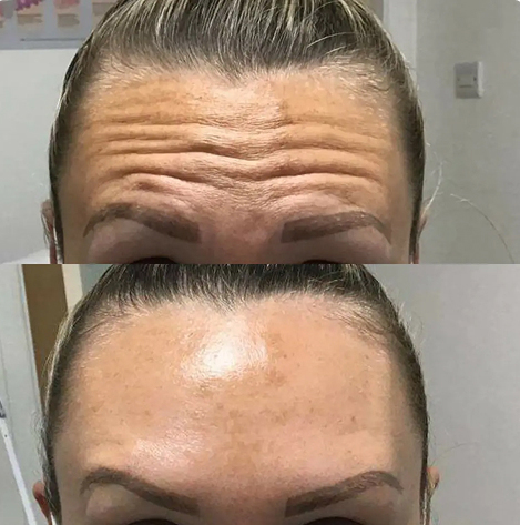 See Our Beautiful Results4